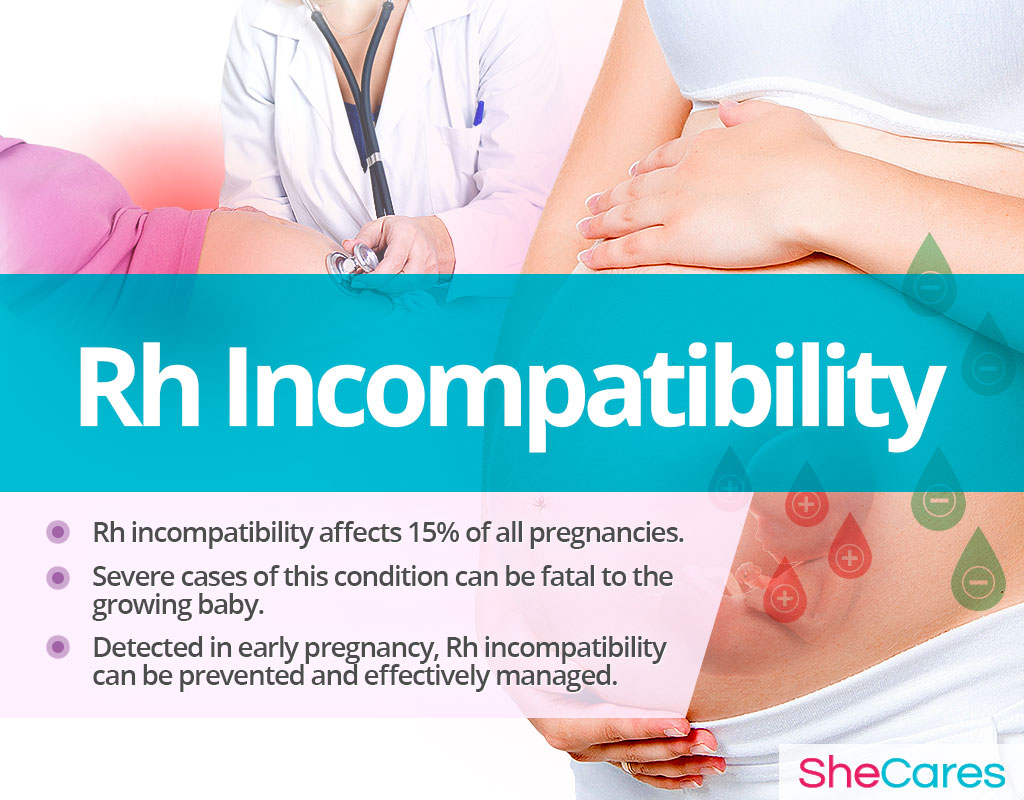 Understanding Rhesus Incompatibility: What Expectant Parents Need to Know